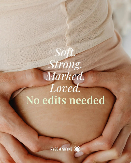Your Stretch Marks Tell a Story, and Hydration Writes the Next Chapter RYSE & SHYNE
